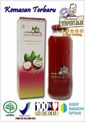 Obat Penyempitan Saluran Kemih Herbal